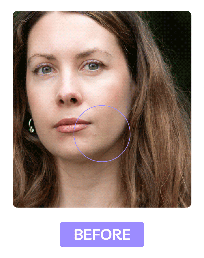 Close-up of woman's face with visible skin blemishes highlighted, prior to retouching in Photoshop.