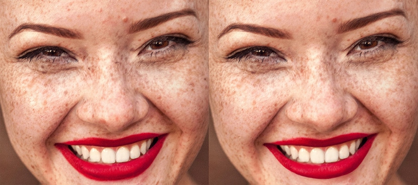 Before and after comparison of blemish removal on skin using Photoshop for enhanced ecommerce photos.